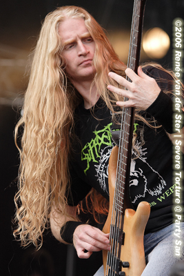 Severe Torture